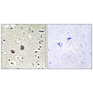 Tie-2兔多抗,Tie-2 Rabbit Polyclonal Antibody