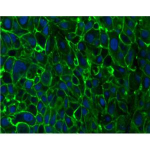 DiO（细胞膜绿色荧光探针）| 细胞膜荧光染料 | EnkiLife恩玑生命