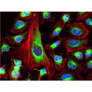 Fluorescein 633-Phalloidin（荧光素633标记鬼笔环肽）,Fluorescein 633-Phalloidin