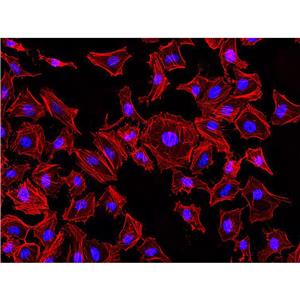 Rhodamine-Phalloidin（罗丹明标记鬼笔环肽）,Rhodamine-Phalloidin