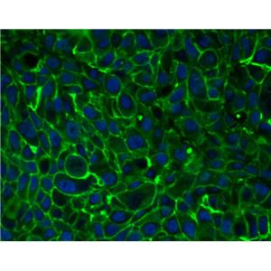 Enhanced DiO（细胞膜绿色荧光探针增强款）| 细胞膜荧光染料 | EnkiLife恩玑生命