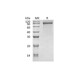 重组人CDH8 (C-6His)蛋白,Recombinant Human CDH8 (C-6His)