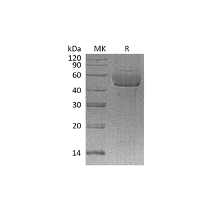 重组人SDC1 (C-6His)蛋白,Recombinant Human SDC1 (C-6His)