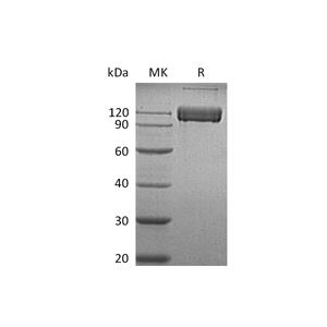 重组人ALCAM (C-Fc)蛋白,Recombinant Human ALCAM (C-Fc)