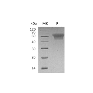 重组人CD55 (C-6His)蛋白,Recombinant Human CD55 (C-6His)