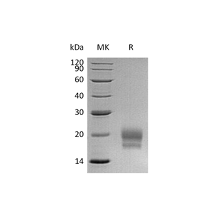 重组人CEACAM3 (C-6His)蛋白,Recombinant Human CEACAM3 (C-6His)