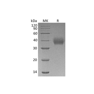 重组人FcAR (C-6His)蛋白,Recombinant Human FcAR (C-6His)