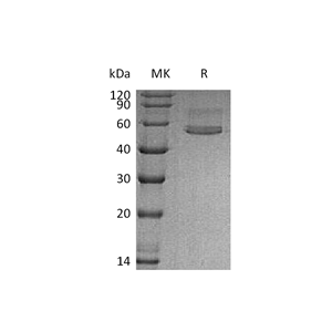 重组人CHIT1 (C-6His)蛋白,Recombinant Human CHIT1 (C-6His)