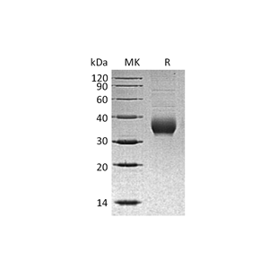 重组人CHRNB3 (C-6His)蛋白,Recombinant Human CHRNB3 (C-6His)