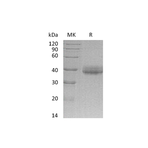 重组人CRELD2 (C-6His)蛋白,Recombinant Human CRELD2 (C-6His)