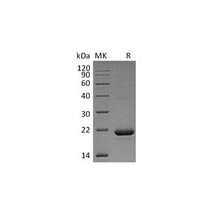 重组人CYB5B (C-6His)蛋白,Recombinant Human CYB5B (C-6His)