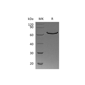 重组人DLL1 (C-6His)蛋白,Recombinant Human DLL1 (C-6His)
