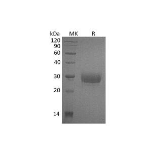 重组人CD32a (H167,C-6His)蛋白,Recombinant Human CD32a (H167,C-6His)