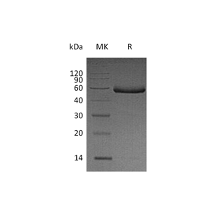 重组人Fetuin B (C-6His)蛋白,Recombinant Human Fetuin B (C-6His)