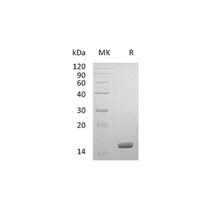 重组人LGALS14 (C-6His)蛋白,Recombinant Human LGALS14 (C-6His)