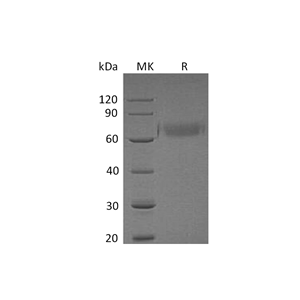 重组人HYOU1 (C-10His)蛋白,Recombinant Human HYOU1 (C-10His)