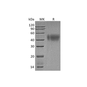 重组人IFNAR2 (C-6His)蛋白,Recombinant Human IFNAR2 (C-6His)