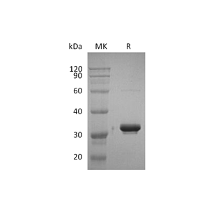 重组人IgG2 Fc (228AA)蛋白,Recombinant Human IgG2 Fc (228AA)