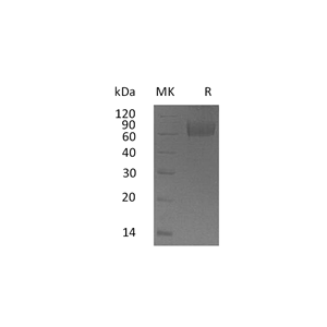重组人IL-18BP (C-Fc)蛋白,Recombinant Human IL-18BP (C-Fc)