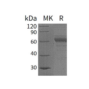 重组人IL-20RB (C-Fc)蛋白,Recombinant Human IL-20RB (C-Fc)