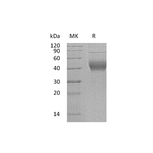 重组人IL-22RA2 (C-6His)蛋白,Recombinant Human IL-22RA2 (C-6His)