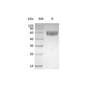 重组人Lumican (C-6His)蛋白,Recombinant Human Lumican (C-6His)