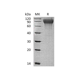重组人MANSC1 (C-6His)蛋白,Recombinant Human MANSC1 (C-6His)