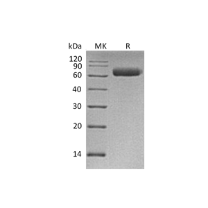 重组人NgR3 (C-6His)蛋白,Recombinant Human NgR3 (C-6His)
