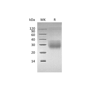 重组人NKG2A & CD94 Heterodimer (N-8His-Flag)蛋白,Recombinant Human NKG2A & CD94 Heterodimer (N-8His-Flag)