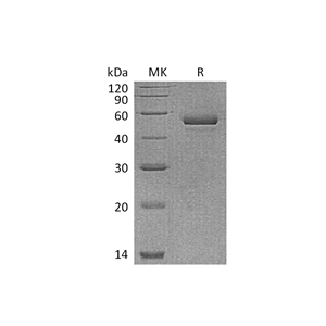 重组人NPTX1 (C-6His)蛋白,Recombinant Human NPTX1 (C-6His)
