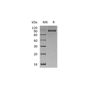 重组人PACSIN2 (C-6His)蛋白,Recombinant Human PACSIN2 (C-6His)
