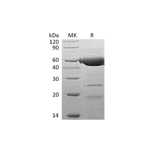 重组人PLRP2 (C-6His)蛋白,Recombinant Human PLRP2 (C-6His)