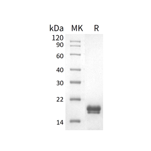 重组人REG1A (C-6His)蛋白,Recombinant Human REG1A (C-6His)