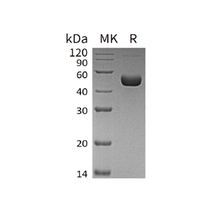 重组人Renin (C-10His)蛋白,Recombinant Human Renin (C-10His)