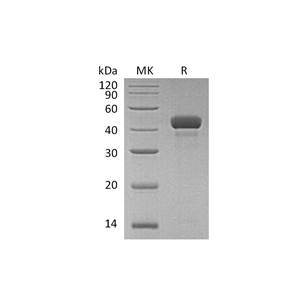 重组人RCN3 (C-6His)蛋白,Recombinant Human RCN3 (C-6His)