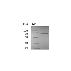 重组人Transferrin (C-6His)蛋白,Recombinant Human Transferrin (C-6His)