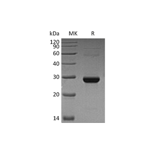重组人TK1 (C-6His)蛋白,Recombinant Human TK1 (C-6His)