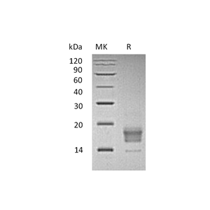 重组人TIGIT (C-6His)蛋白,Recombinant Human TIGIT (C-6His)