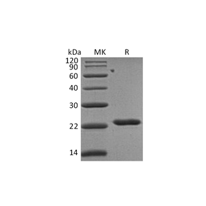 重组人TIMP-2 (C-6His)蛋白,Recombinant Human TIMP-2 (C-6His)