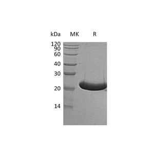 重组人TREML1 (C-6His)蛋白,Recombinant Human TREML1 (C-6His)