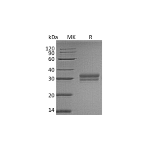 重组人VSIG2 (C-6His)蛋白,Recombinant Human VSIG2 (C-6His)