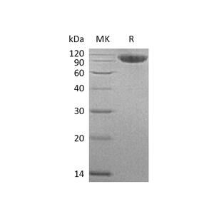 重组人CFHR4 (C-6His)蛋白,Recombinant Human CFHR4 (C-6His)