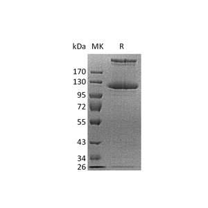 重组人COL21A1 (C-6His)蛋白,Recombinant Human COL21A1 (C-6His)