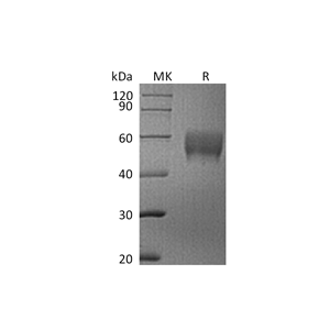 重组人Siglec-7 (C-6His)蛋白,Recombinant Human Siglec-7 (C-6His)