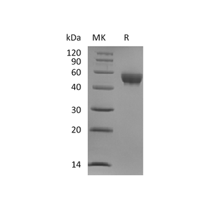 重组人Siglec-8 (C-6His)蛋白,Recombinant Human Siglec-8 (C-6His)