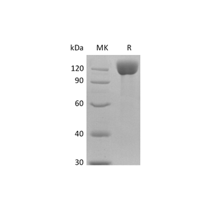 重组人APN Protein (C-6His)蛋白,Recombinant Human APN Protein (C-6His)