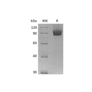 重组人Neuropilin-1 (C-6His)蛋白,Recombinant Human Neuropilin-1 (C-6His)