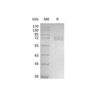 重组人Siglec-6 (C-Fc)蛋白,Recombinant Human Siglec-6 (C-Fc)