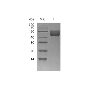 重组小鼠CD147 (C-6His)蛋白,Recombinant Mouse CD147 (C-6His)