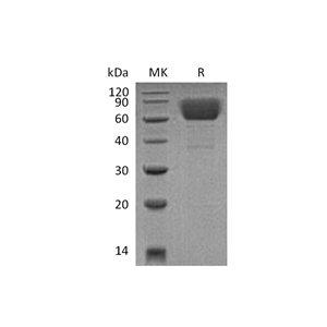 重组小鼠CD39 (C-6His)蛋白,Recombinant Mouse CD39 (C-6His)